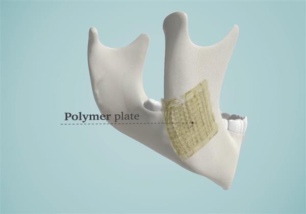 解決醫(yī)生煩惱 3D打印生物陶瓷修復(fù)骨骼


生物陶瓷,3D打印生物陶瓷,工業(yè)3d打印機(jī),3D打印機(jī)價(jià)格,3D打印服務(wù),3D打印技術(shù),中國(guó)3d打印技術(shù),上海3D打印,北京3D打印