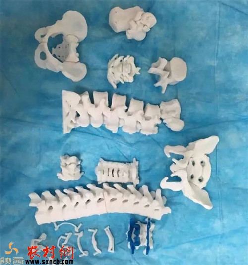 3D打印人體椎骨 3D打印人體椎骨