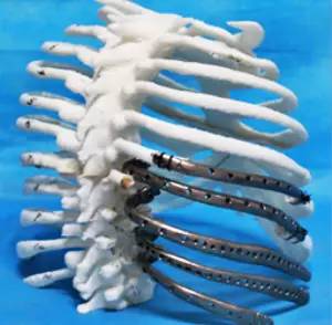 第四軍醫(yī)大學(xué)精彩分享個性化醫(yī)療3D打印的實戰(zhàn)案例與研究成果 第四軍醫(yī)大學(xué)精彩分享個性化醫(yī)療3D打印的實戰(zhàn)案例與研究成果