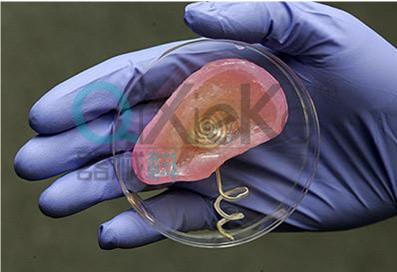 個性化醫(yī)療3D打印實戰(zhàn)案例與研究成果的問答整理_3d打印服務(wù)公司